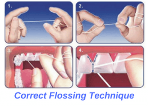 dental-floss-technique