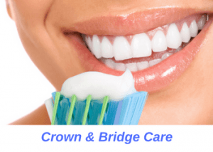 Crown-Bridge-Care