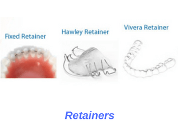 Different-types-orthodontic-retainers