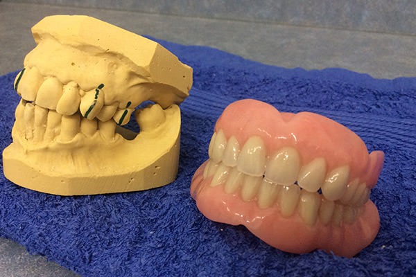 Teeth Extractions For Dentures  - This Section Will Give Advice On All You Need To Know About Having Teeth Removed.