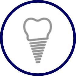 implant-dentistry-specialist