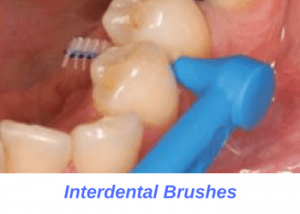 interproximal-cleaner-orange-county