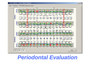 dental-cleaning-periodontal-evaluation