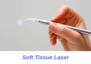 Soft-Tissue-Laser-orange-county