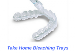 Take-Home-Teeth-Whitening