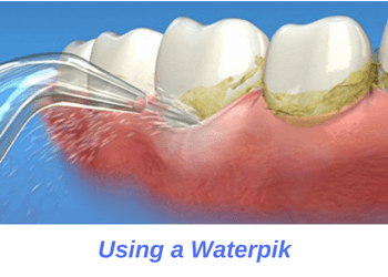 Using-Waterpik