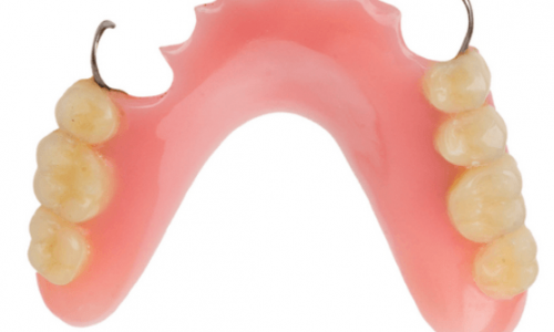 denture-partial