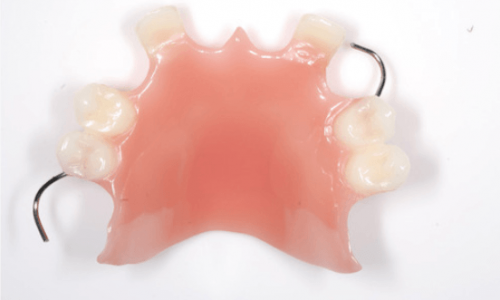 partial-denture-acrylic