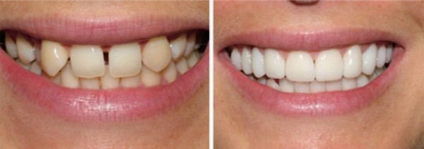 cosmetic-dentistry