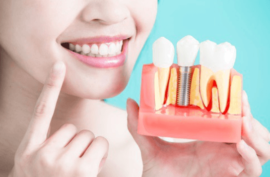 Dental-Implant-Treatment