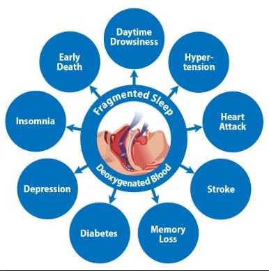 Obstructive-Sleep-Apnea-symptoms