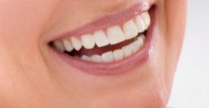 Porcelain-veneers-orange-county