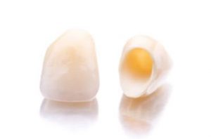 ceramic-zirconia-crowns