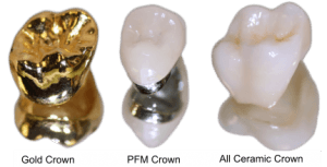 crown-material
