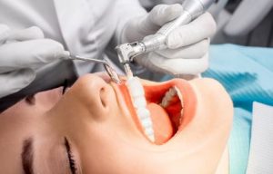 dental-cleaning-frequency
