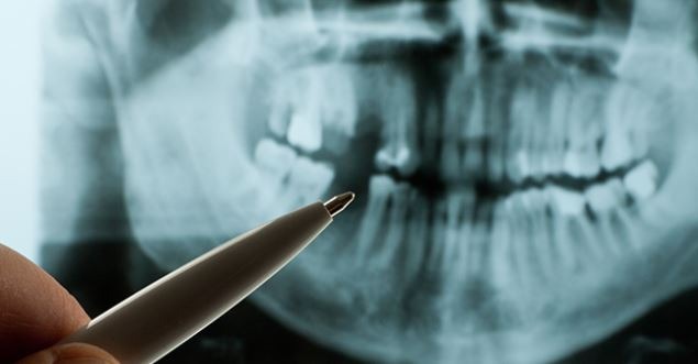 dental-implant-center-orange-county