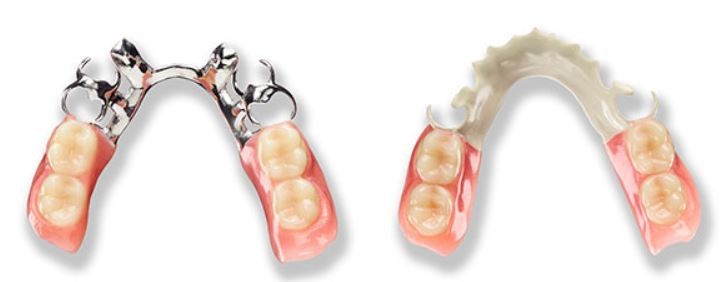Dentures At 31  - Dentures, Removable Replacements For Missing Teeth, Are Available As Partial Dentures And Complete Dentures.