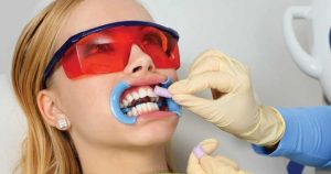 teeth-whitening-dentist