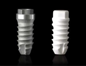 implant-post-titanium-ceramic