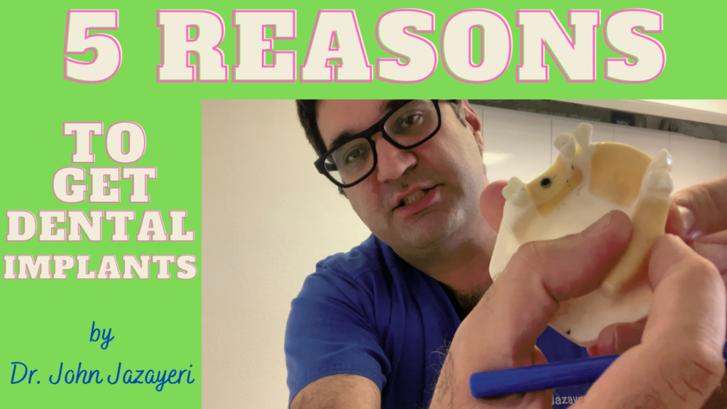 5-reasons-why-you-should-get-dental-implants-thumbnail-final