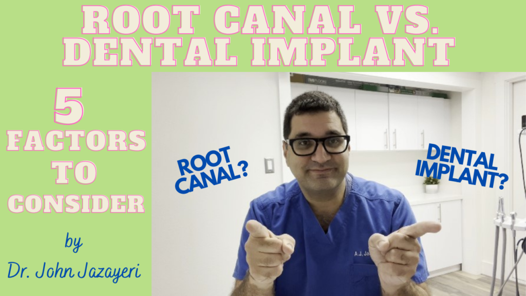 root canal versus dental implant