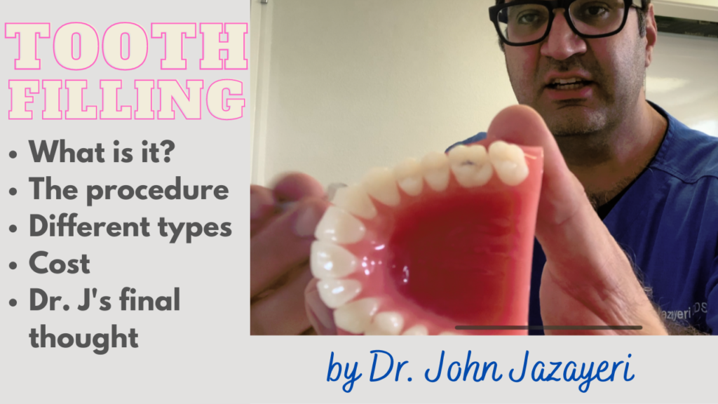 Dental Fillings – Oceansight Dental & Implants